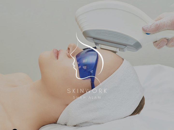 Shop Skinwork on Atome