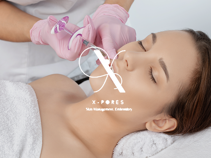 X-Pores