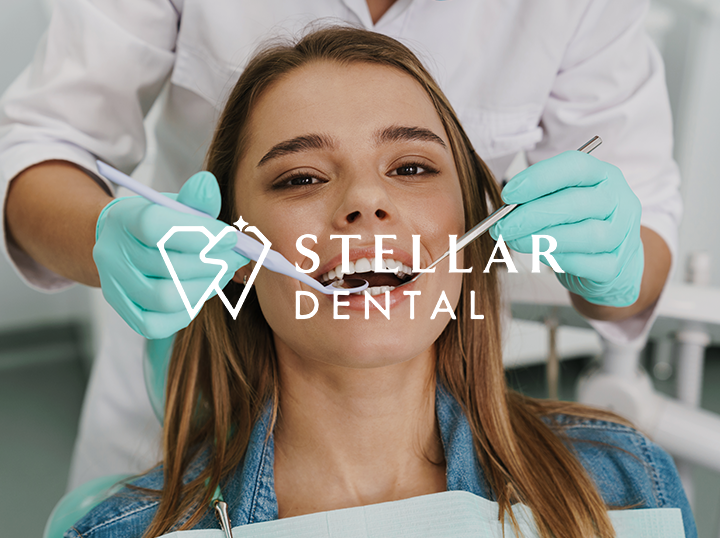 Shop STELLAR ACUMEN on Atome