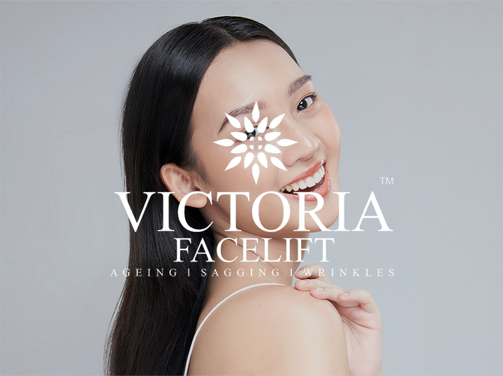 VICTORIA FACELIFT