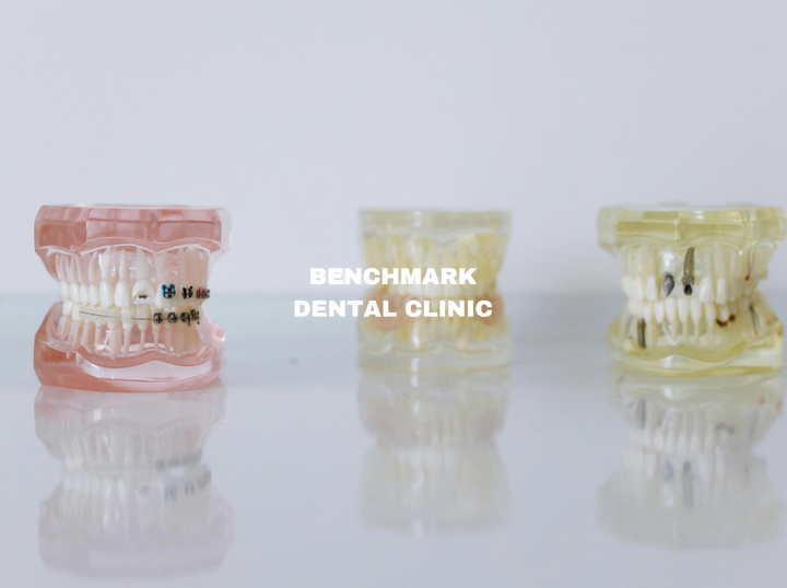 Shop Benchmark Dental Clinic on Atome